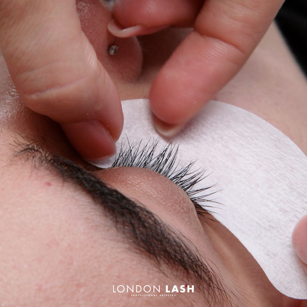 close-up to closed eye showcasing correct application of eye patches