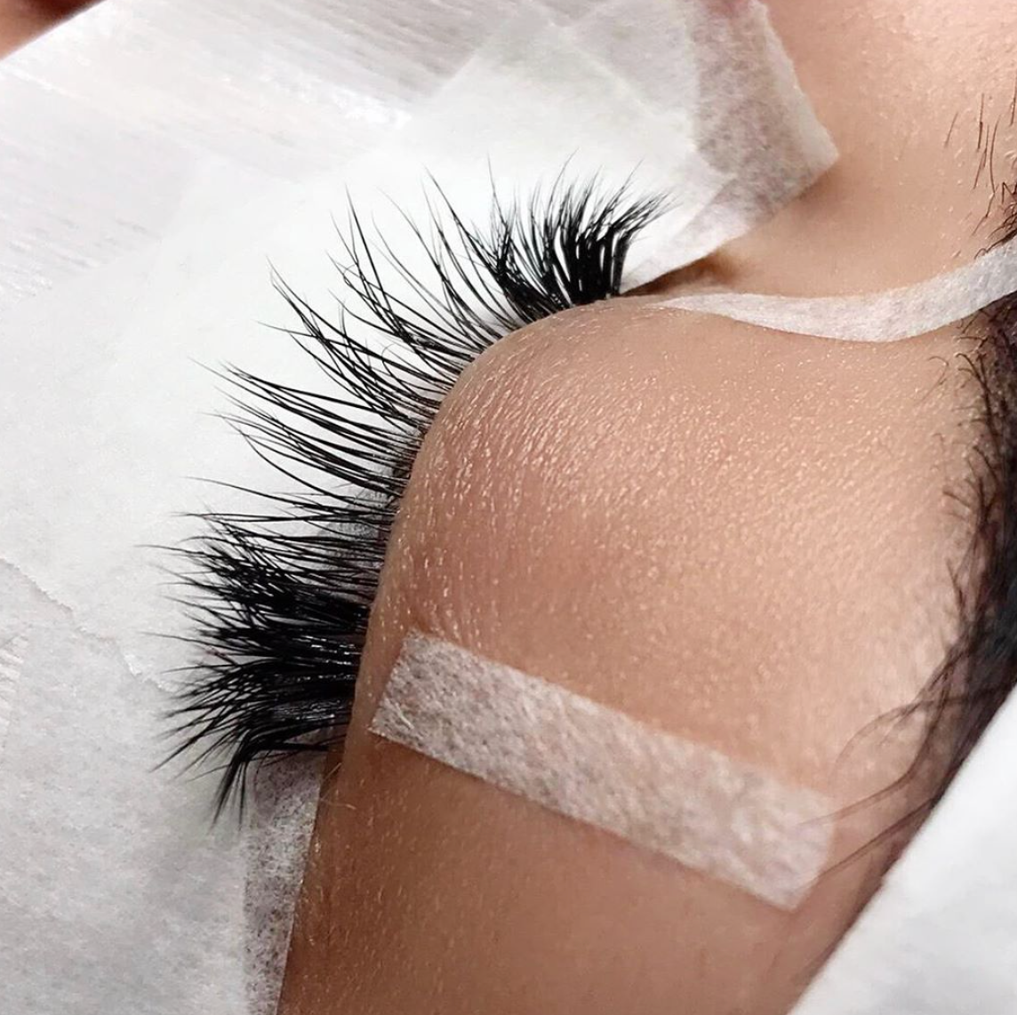 best 3M micropore tape being used to lift the inner and outer corners of the eyelid